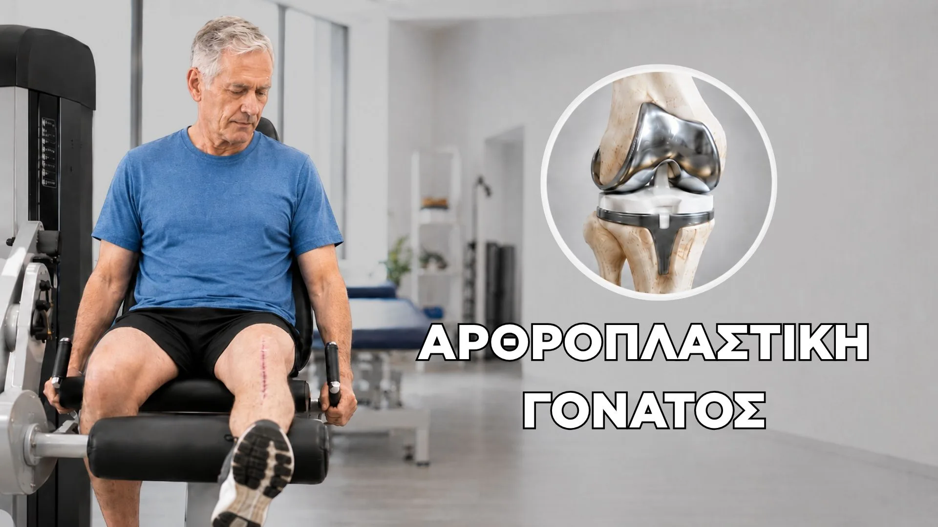 Αρθροπλαστική Γόνατος: Αποκατάσταση, Στάδια και Τι να Περιμένεις