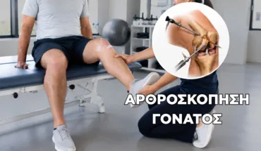 Αρθροσκόπηση Γόνατος: Αποκατάσταση - Τι Πρέπει να Κάνεις για να Επιστρέψεις με Ασφάλεια