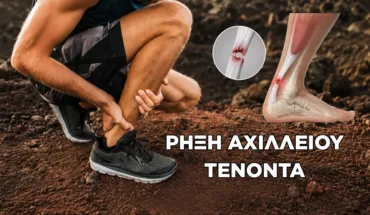 Ρήξη Αχιλλείου: Συμπτώματα, Θεραπεία και Αποκατάσταση